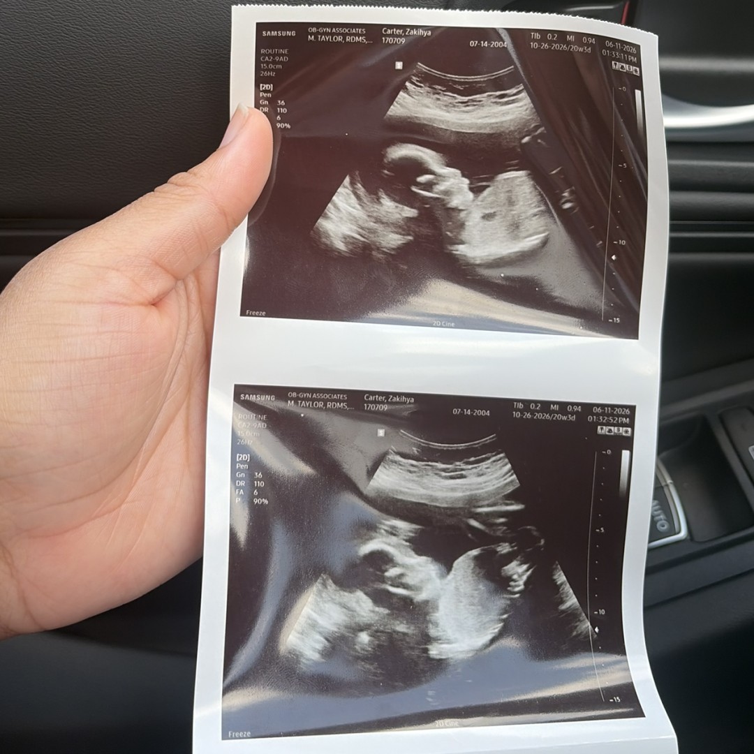 Photo shared by Zakihya for their Babylist baby registry.