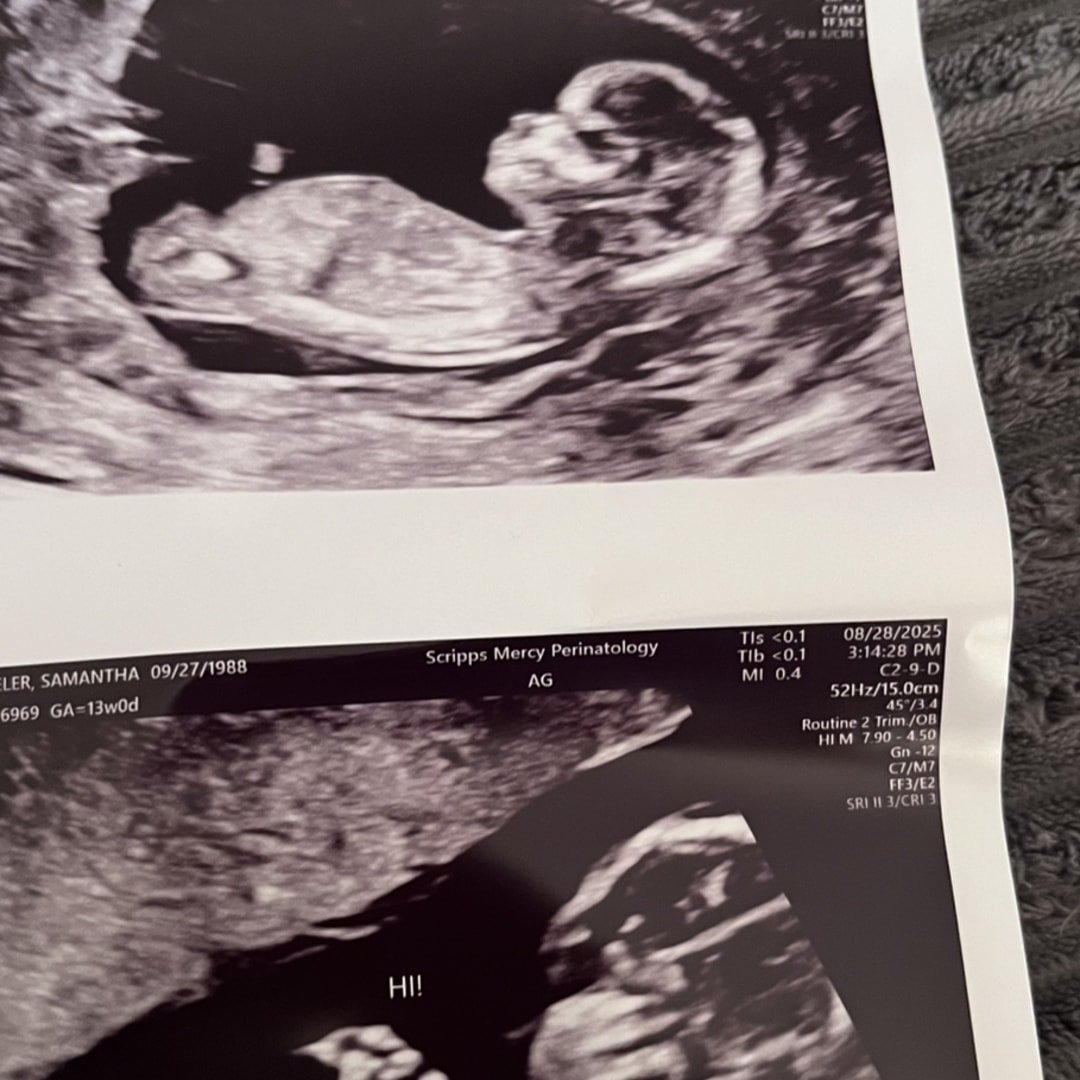 Photo shared by SAMANTHA for their Babylist baby registry.