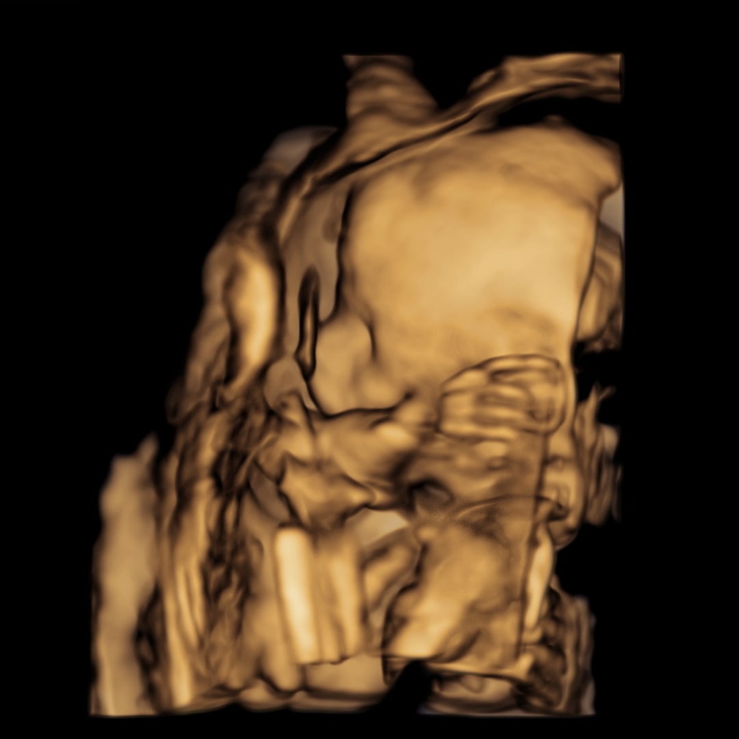 Photo shared by Alyssa for their Babylist baby registry.