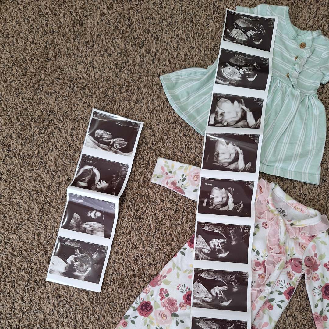 Photo shared by Alexandra for their Babylist baby registry.