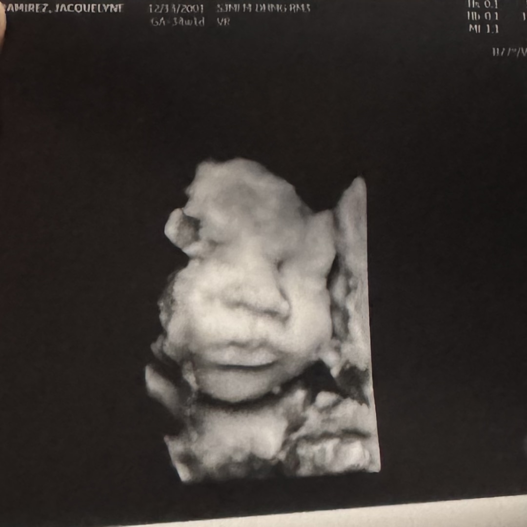 Photo shared by Jackie for their Babylist baby registry.
