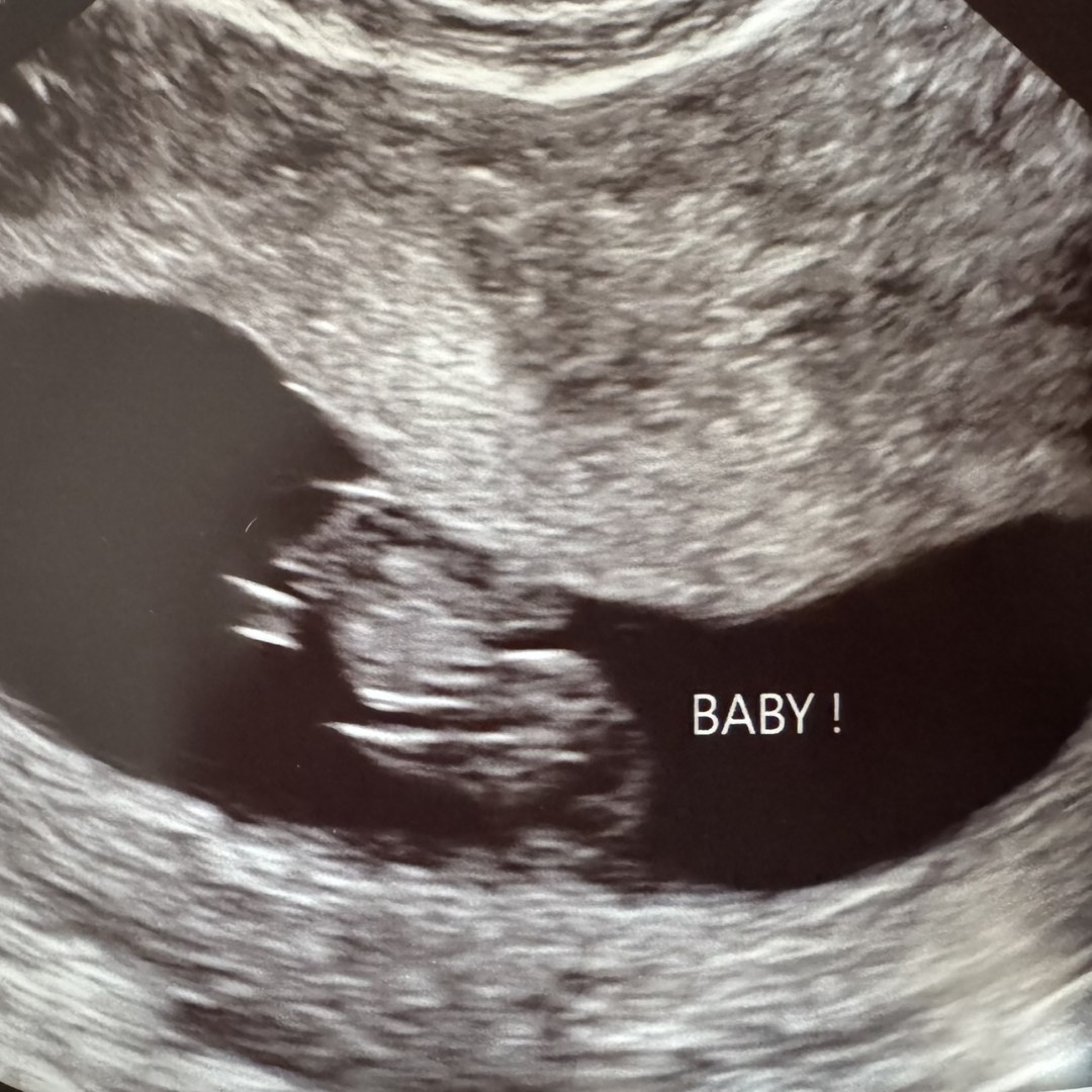 Photo shared by Emily for their Babylist baby registry.