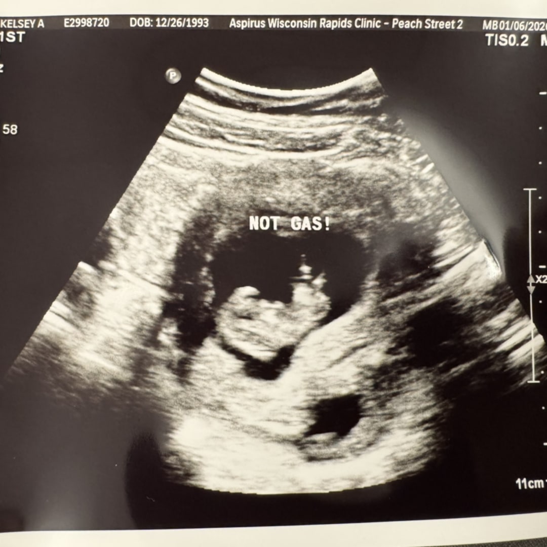 Photo shared by Kelsey for their Babylist baby registry.