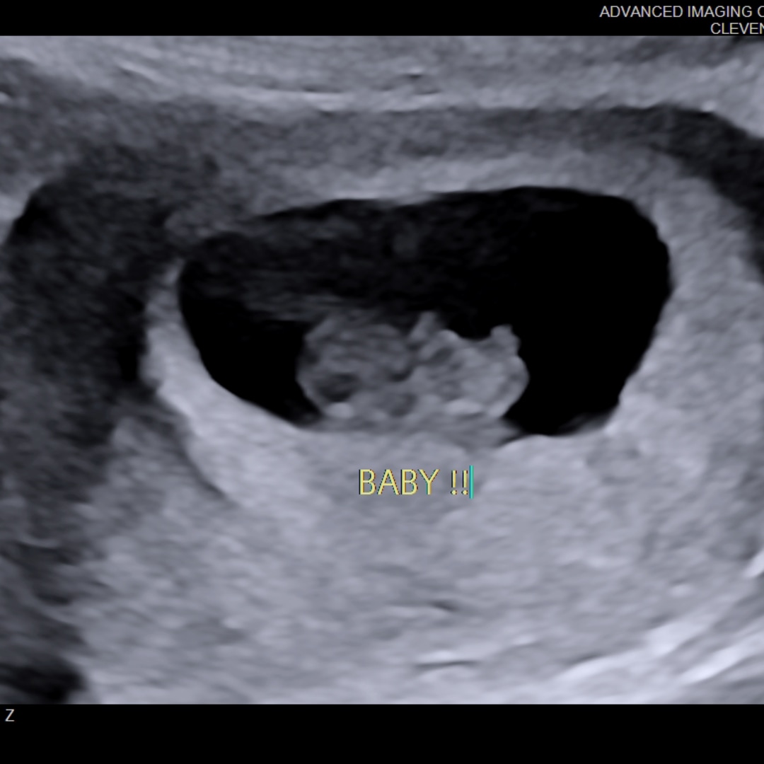 Photo shared by Camy for their Babylist baby registry.