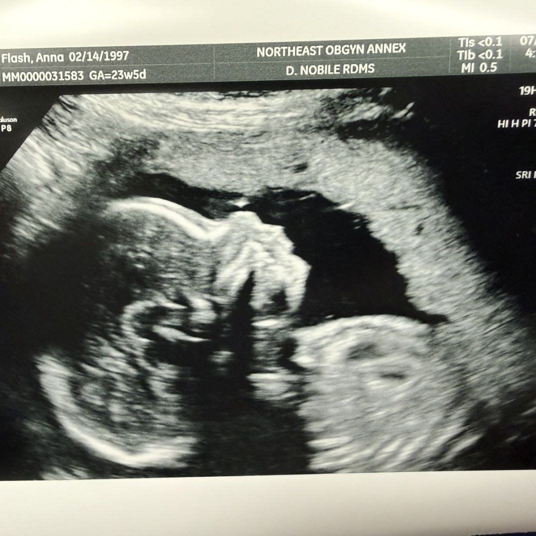 Photo shared by Anna for their Babylist baby registry.