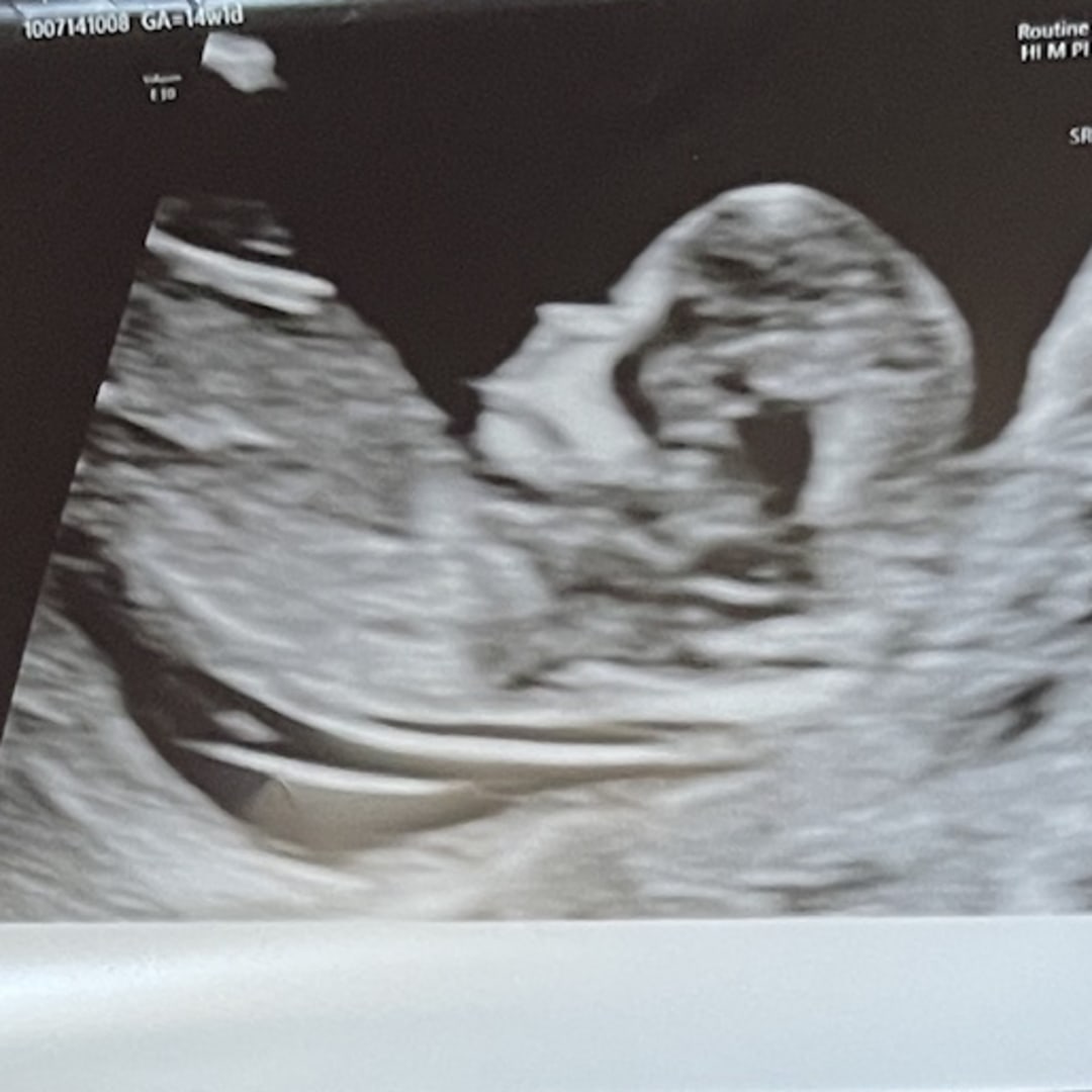 Photo shared by Gloria for their Babylist baby registry.