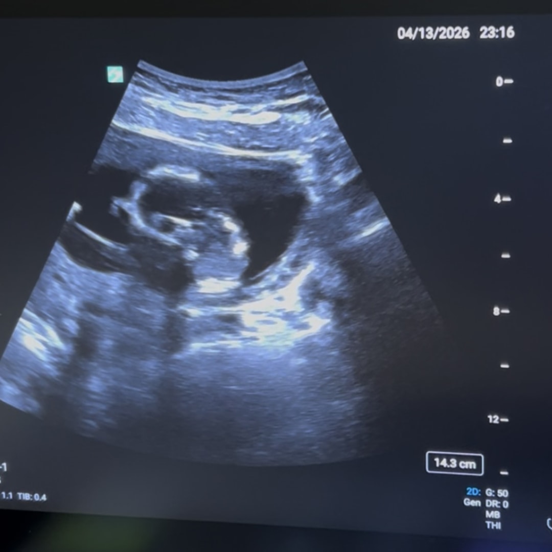 Photo shared by Jordan for their Babylist baby registry.