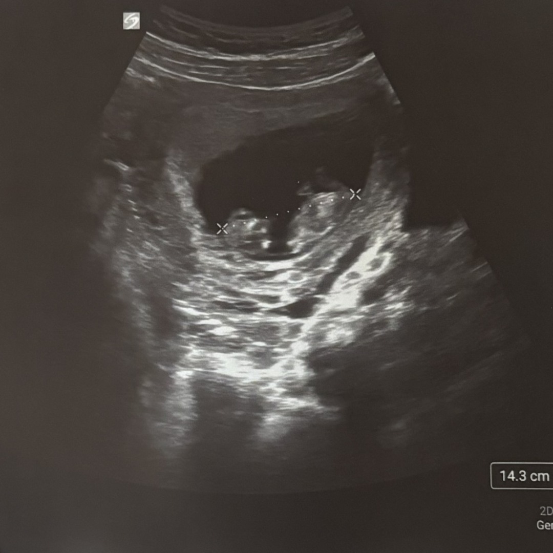 Photo shared by Ashley for their Babylist baby registry.