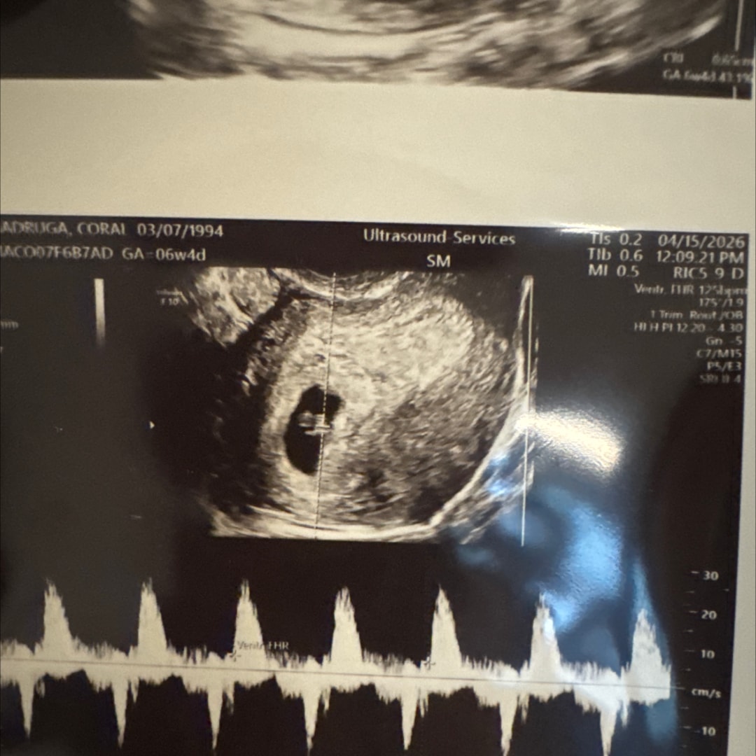 Photo shared by Coral for their Babylist baby registry.
