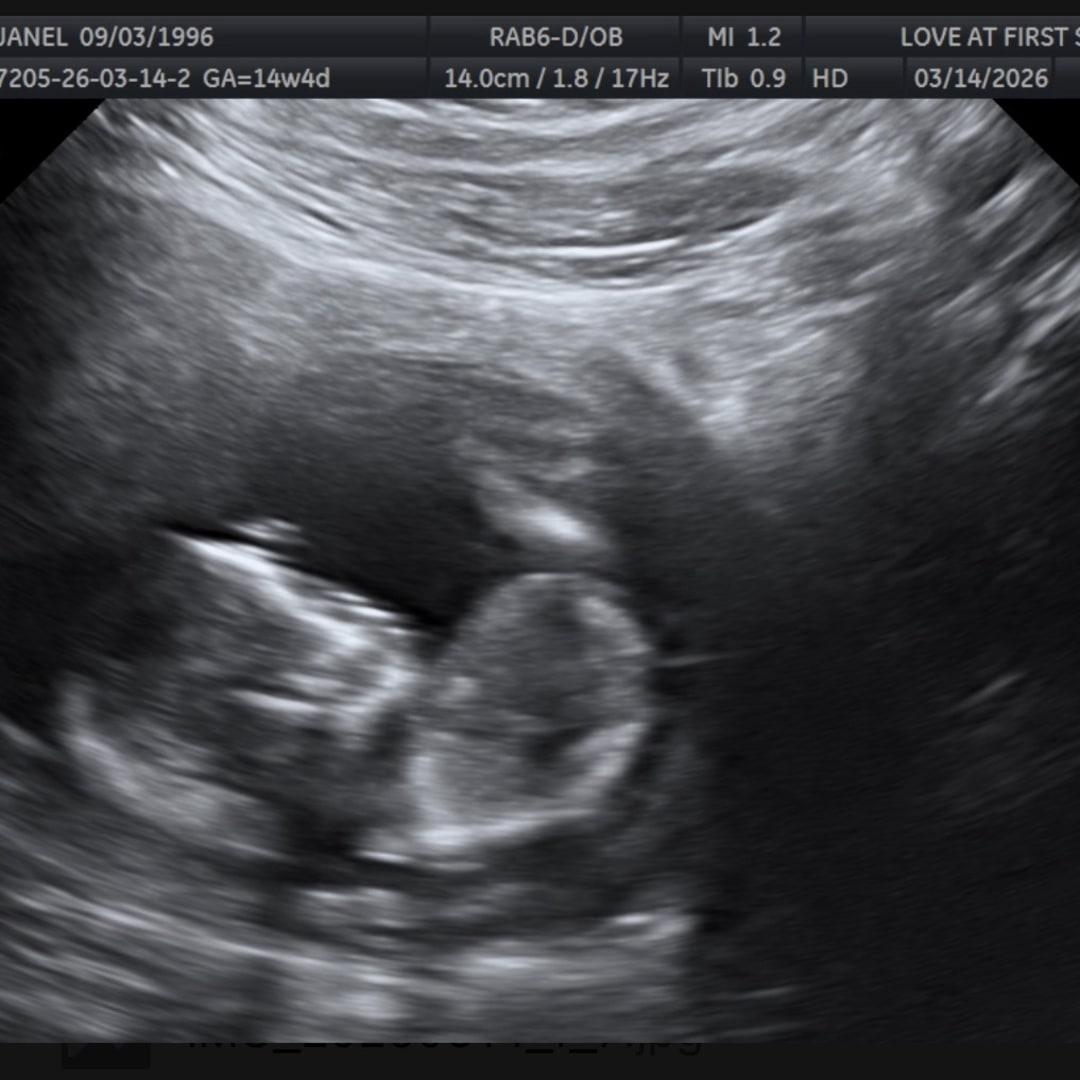 Photo shared by Janel for their Babylist baby registry.