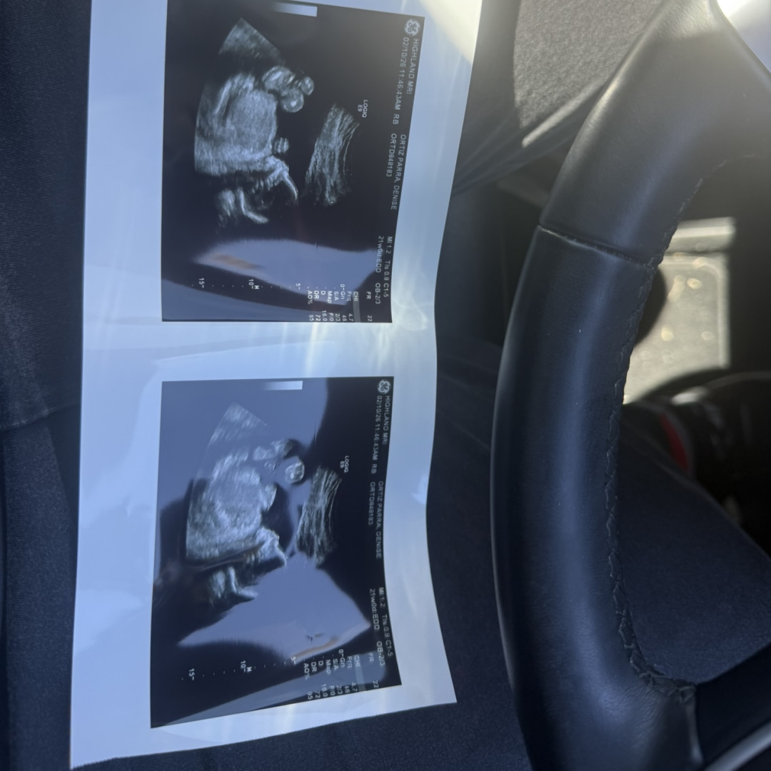 Photo shared by Denise for their Babylist baby registry.