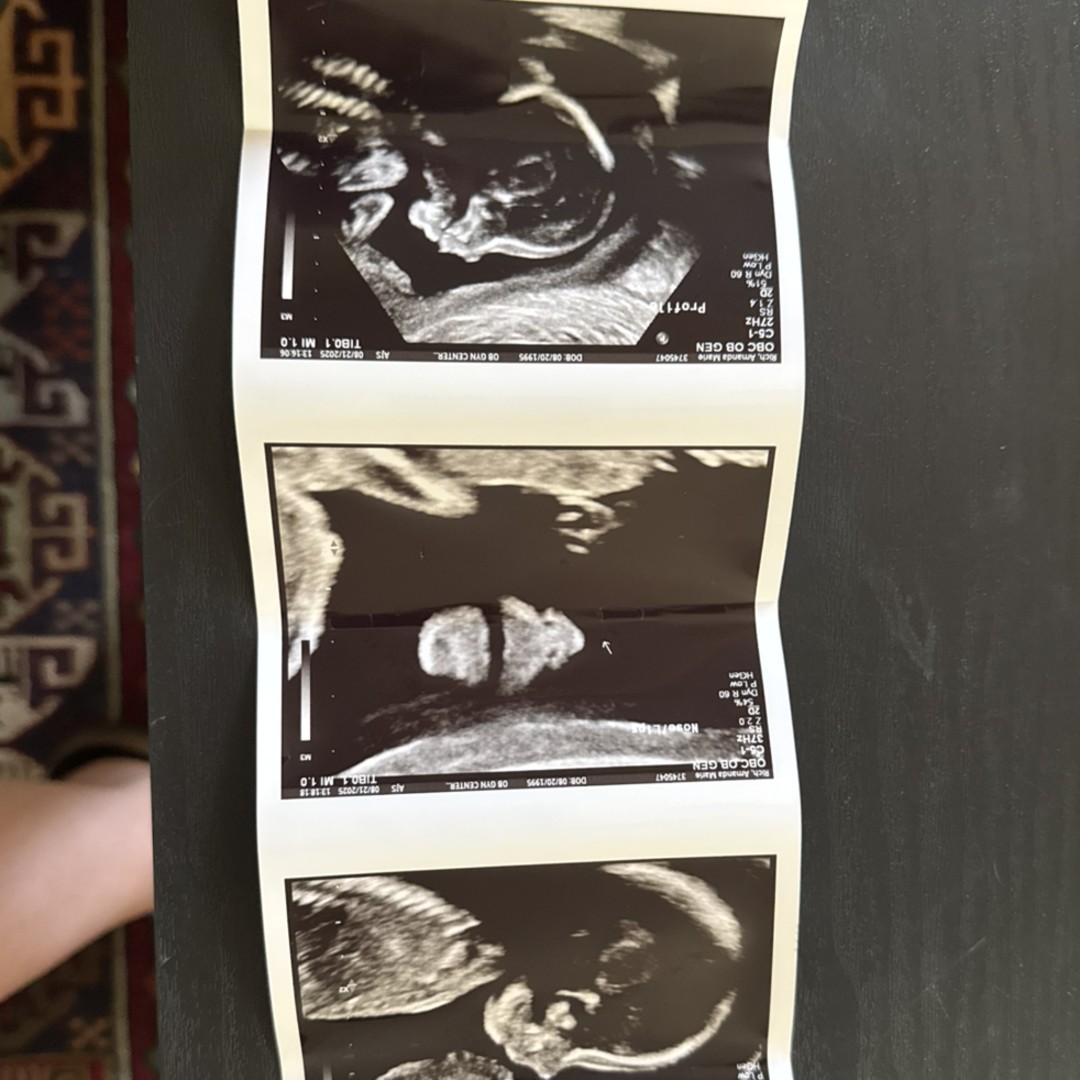 Photo shared by Amanda for their Babylist baby registry.