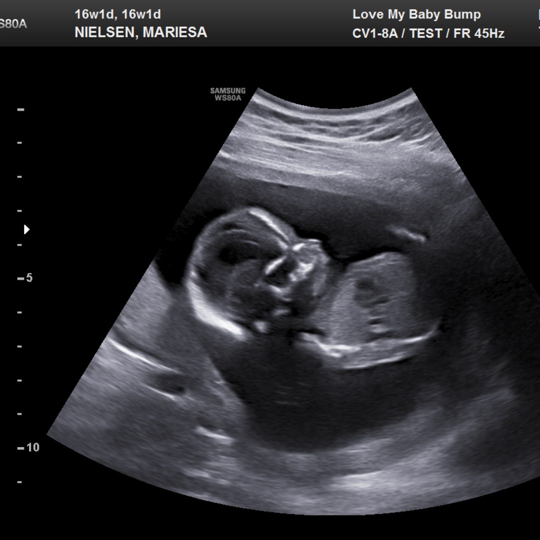 Photo shared by Mariesa for their Babylist baby registry.
