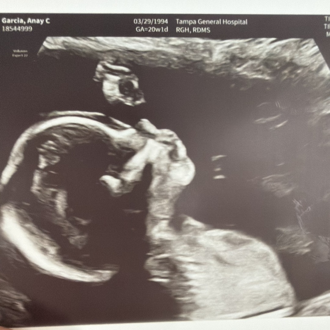 Photo shared by Anay for their Babylist baby registry.