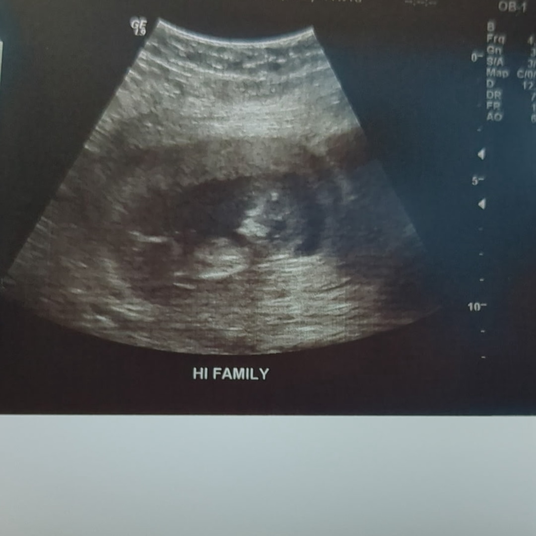 Photo shared by Sarah for their Babylist baby registry.