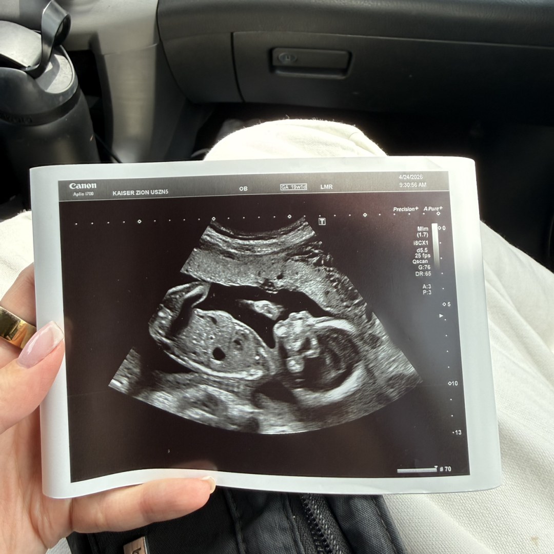Photo shared by Sarah for their Babylist baby registry.