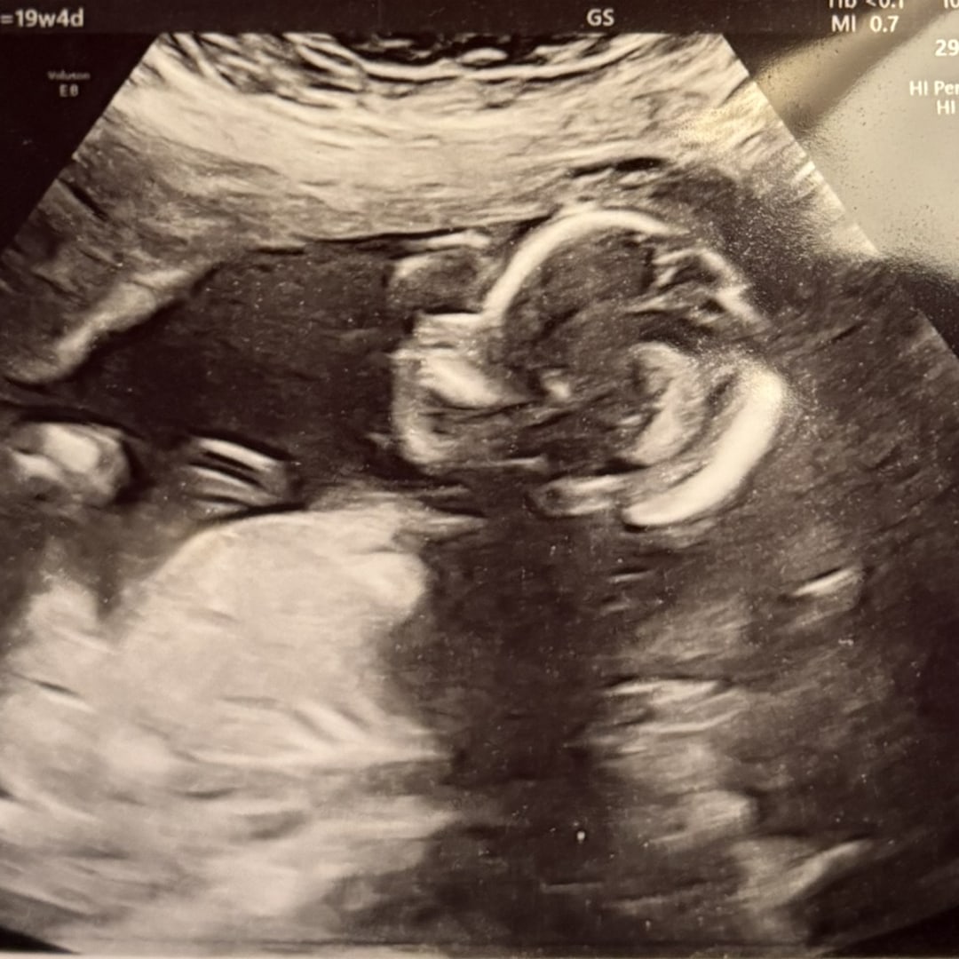 Photo shared by Anna for their Babylist baby registry.