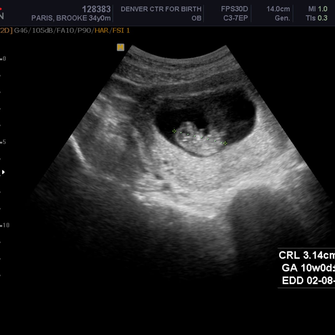 Photo shared by Brooke for their Babylist baby registry.