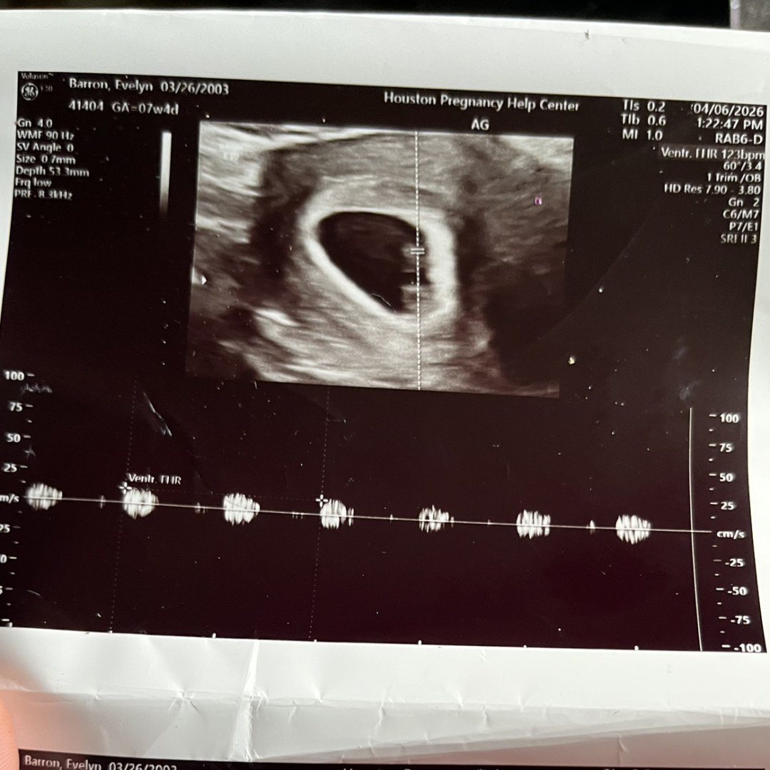 Photo shared by Evelyn for their Babylist baby registry.