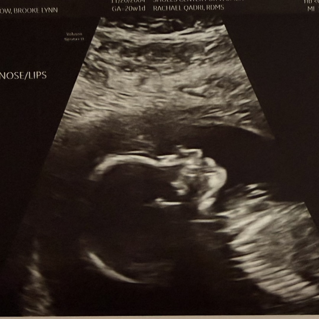 Photo shared by Brooke-Lynn for their Babylist baby registry.