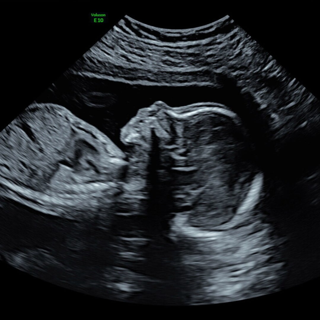 Photo shared by Catherine for their Babylist baby registry.