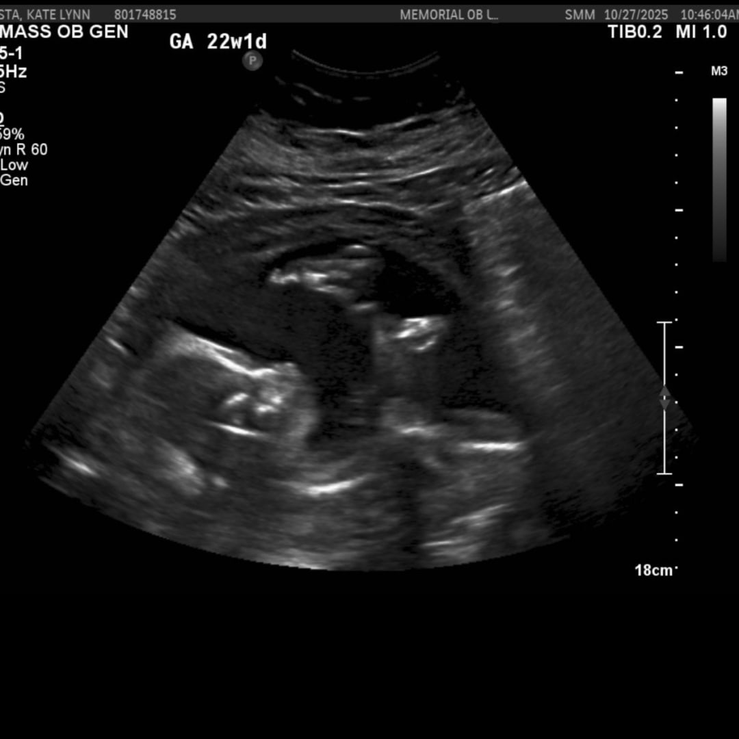 Photo shared by Kate-Lynn for their Babylist baby registry.