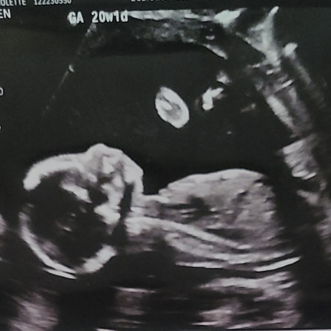Photo shared by Nicolette for their Babylist baby registry.