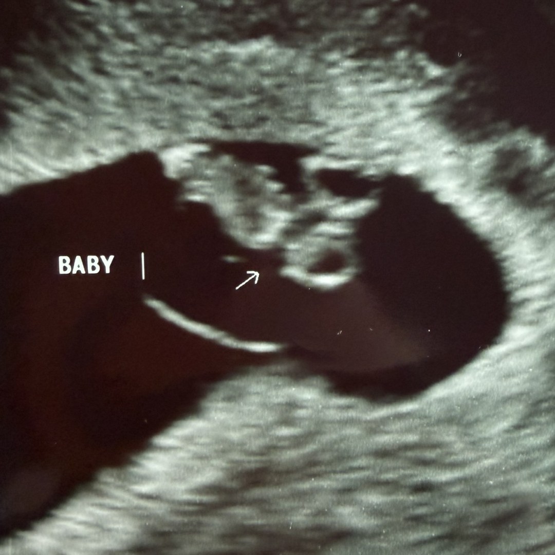 Photo shared by Jessie for their Babylist baby registry.