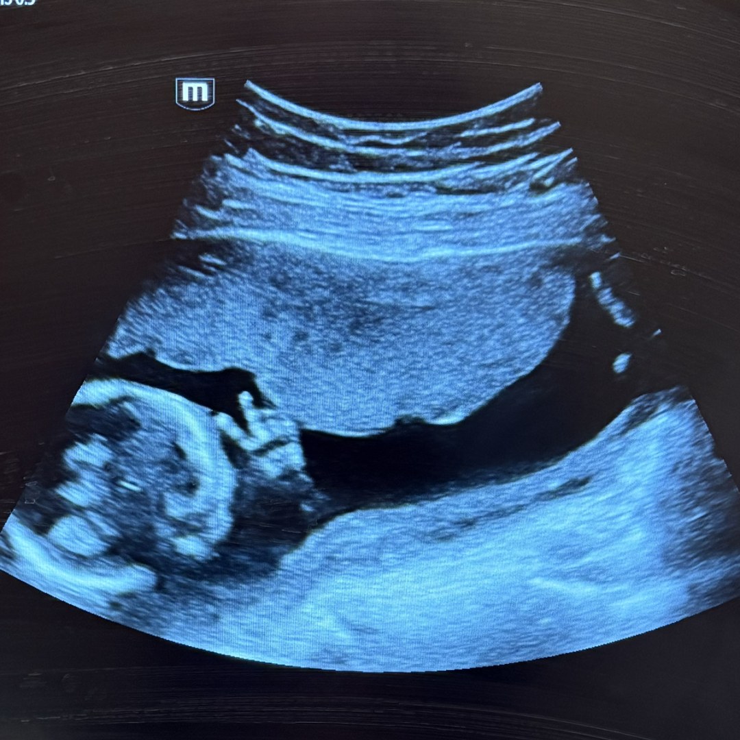 Photo shared by Grace for their Babylist baby registry.