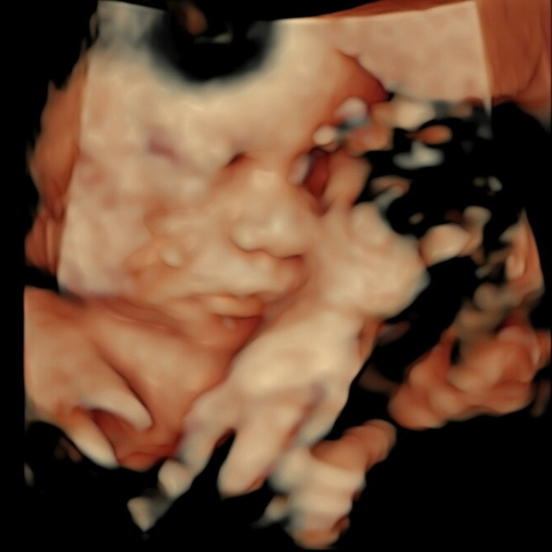 Photo shared by Jenny for their Babylist baby registry.