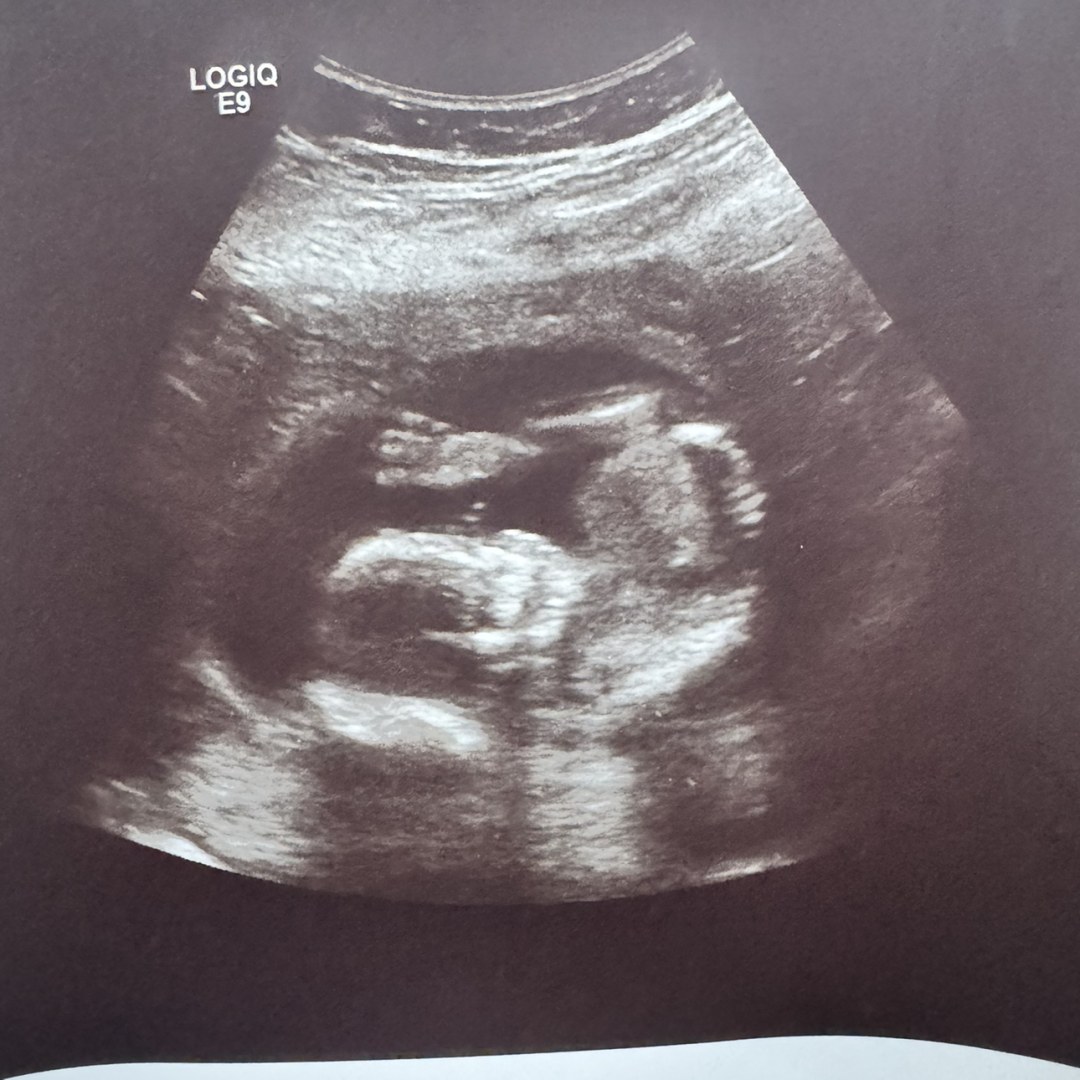 Photo shared by Kimberly for their Babylist baby registry.