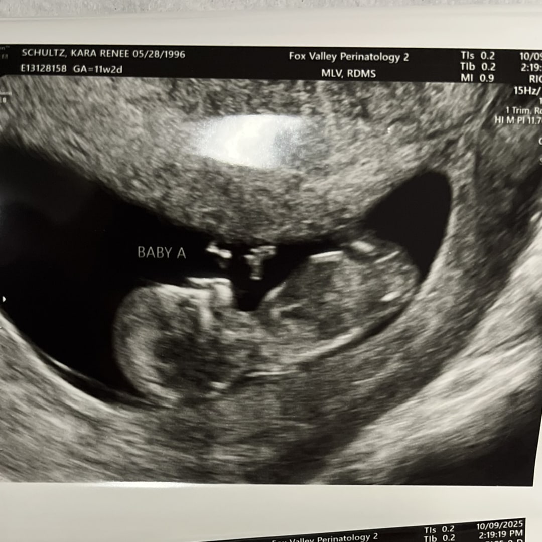 Photo shared by Kara for their Babylist baby registry.