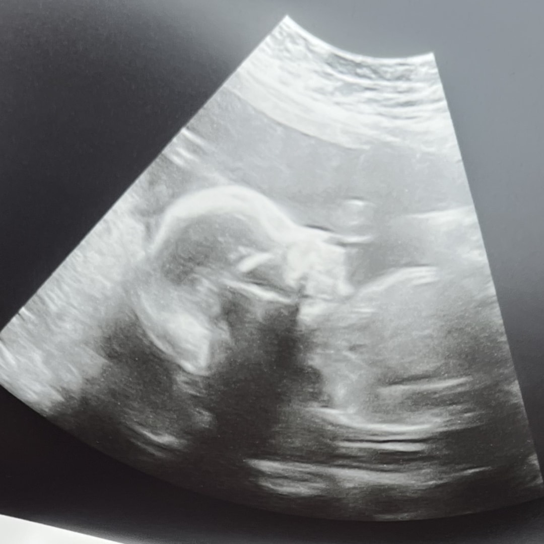 Photo shared by Dasia for their Babylist baby registry.