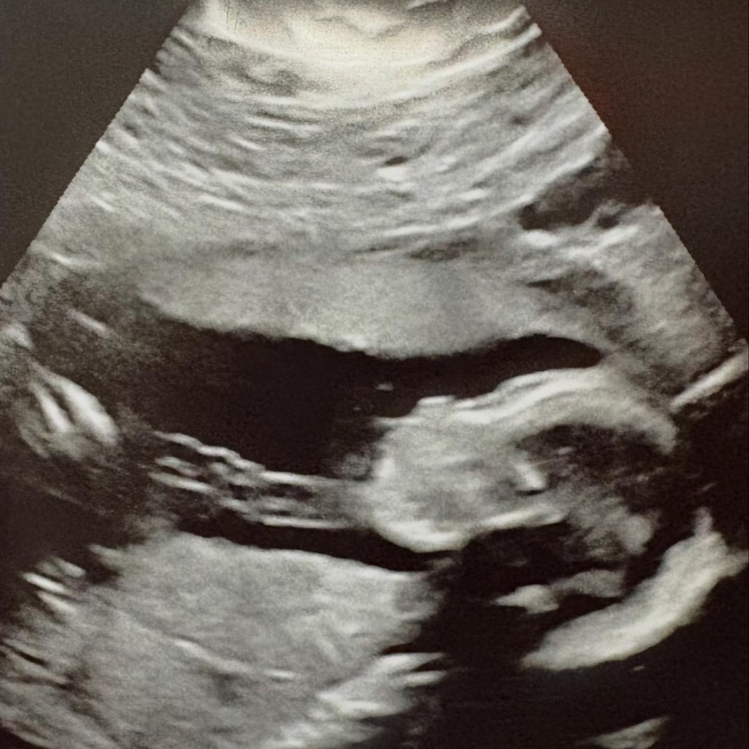 Photo shared by Anna for their Babylist baby registry.