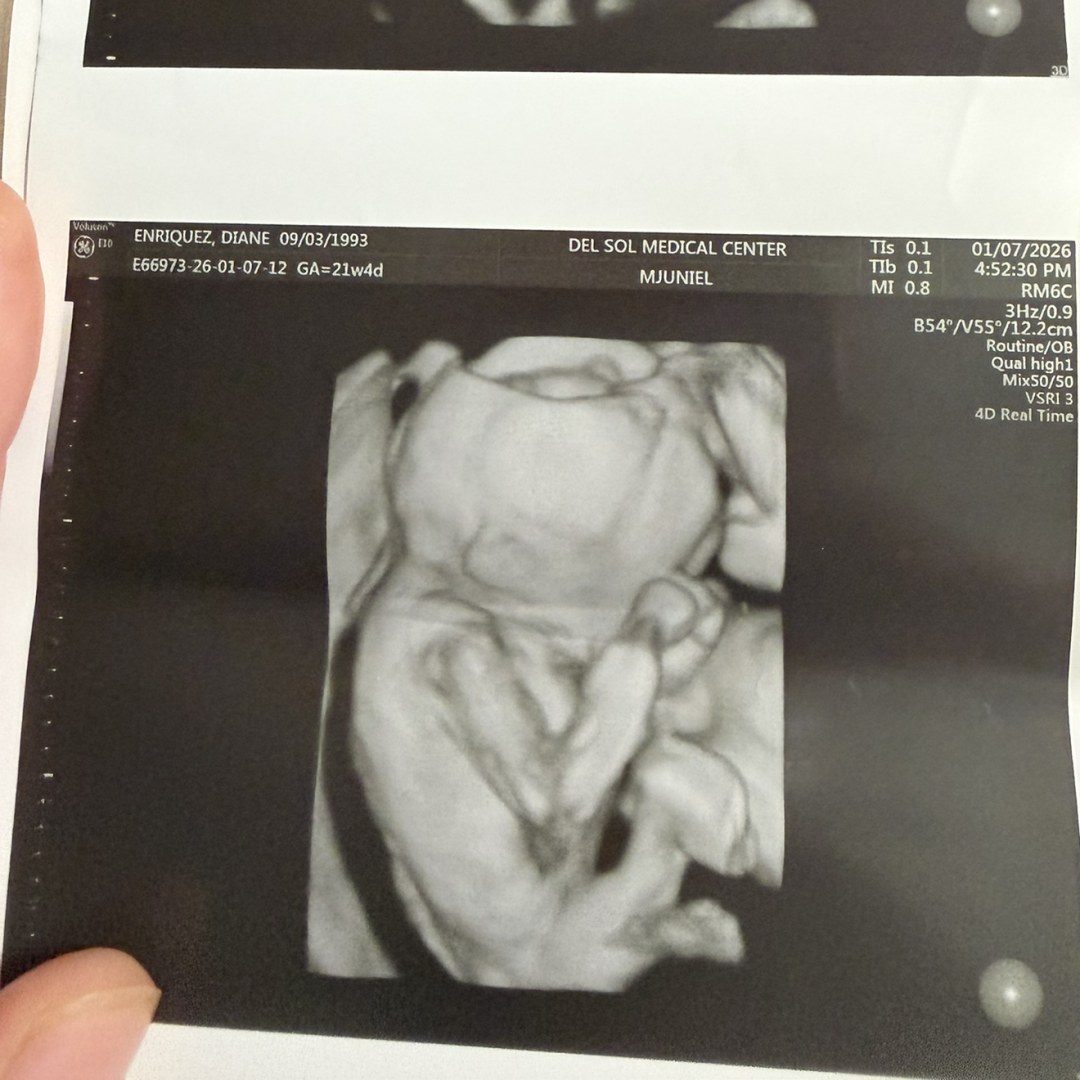 Photo shared by Diane for their Babylist baby registry.