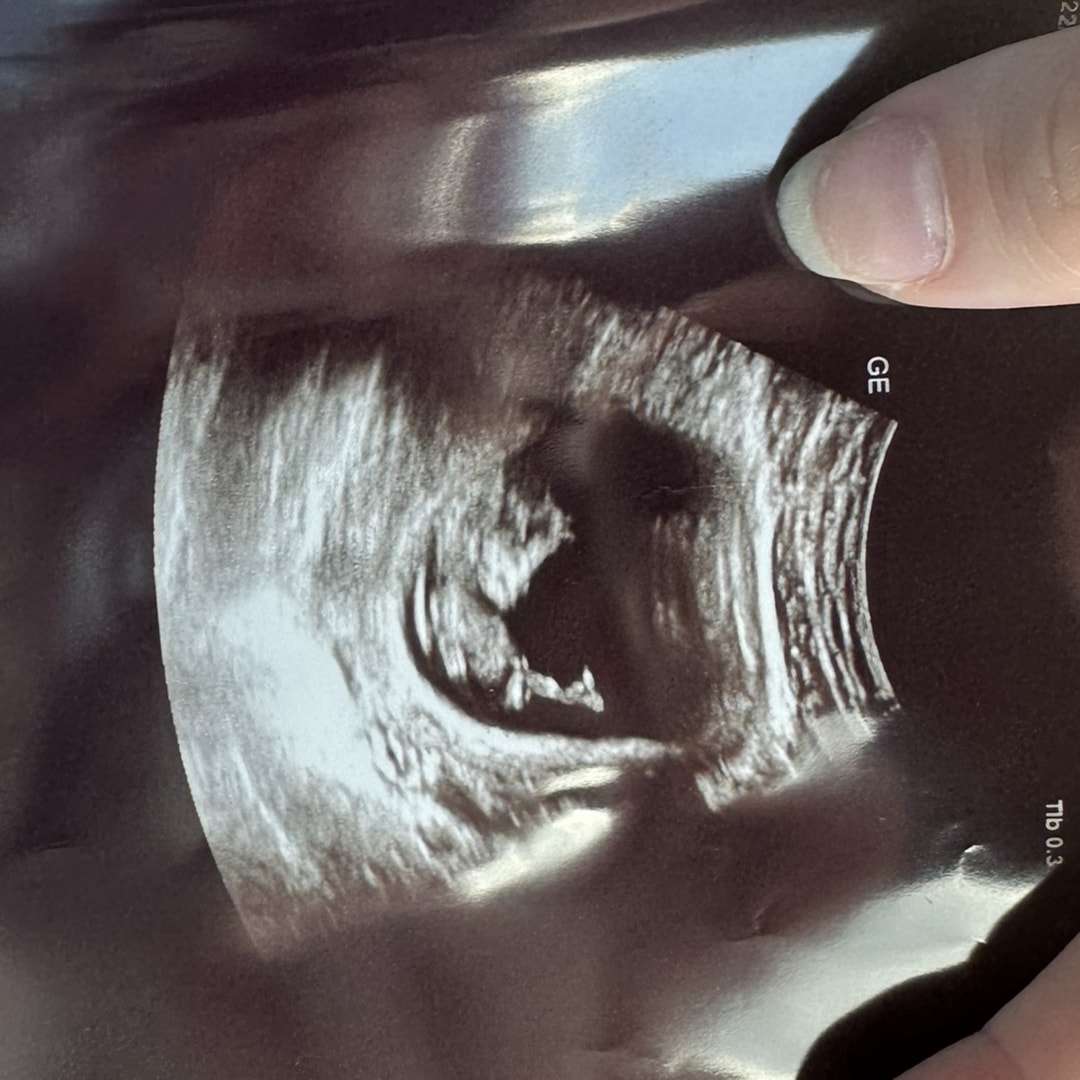 Photo shared by Zoe for their Babylist baby registry.