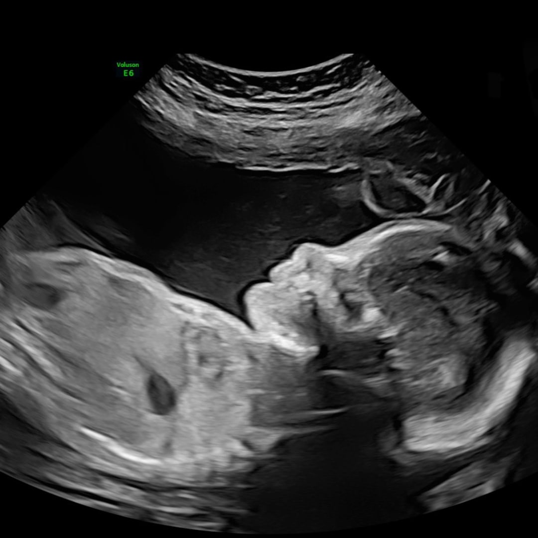 Photo shared by Justice for their Babylist baby registry.