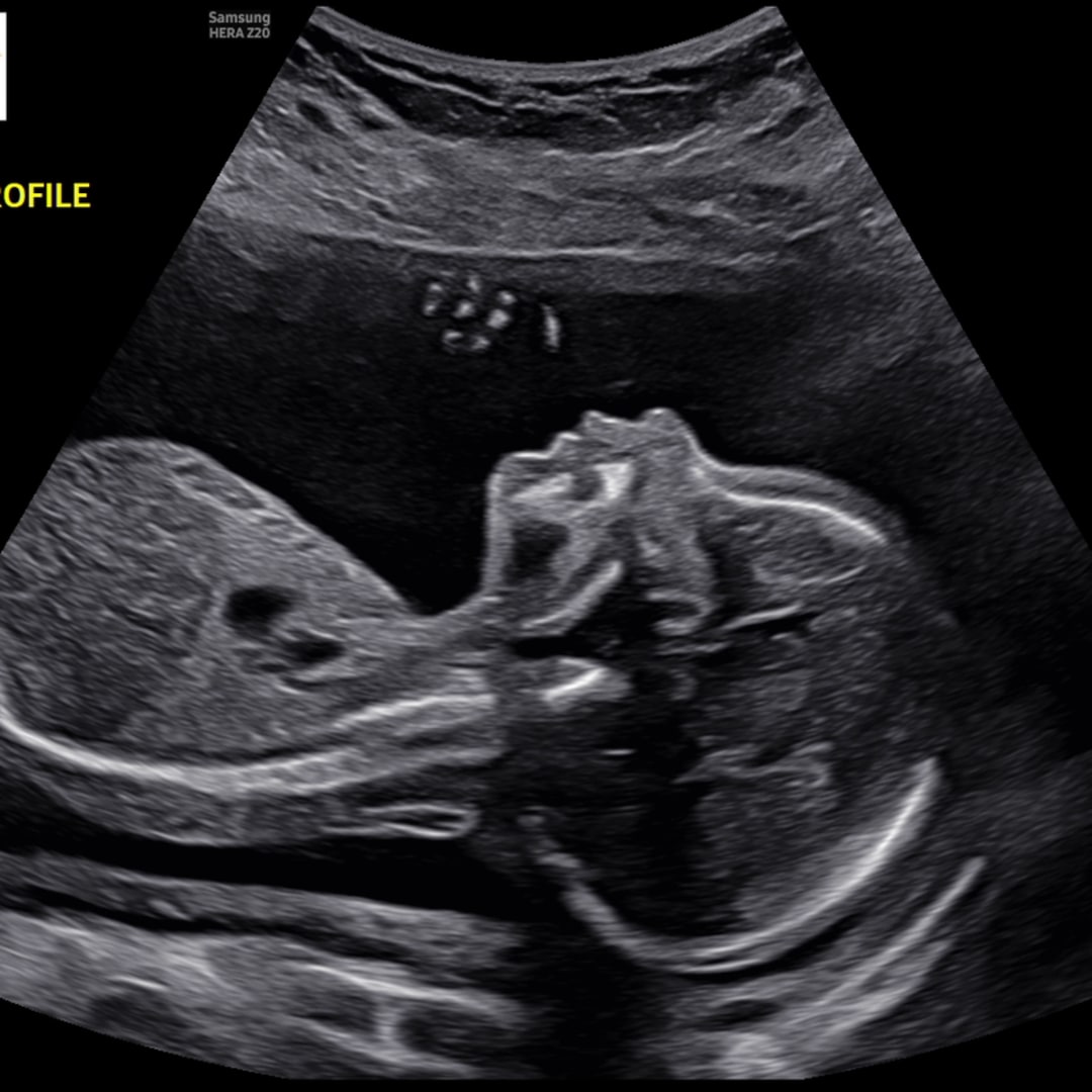 Photo shared by Jasmyne for their Babylist baby registry.