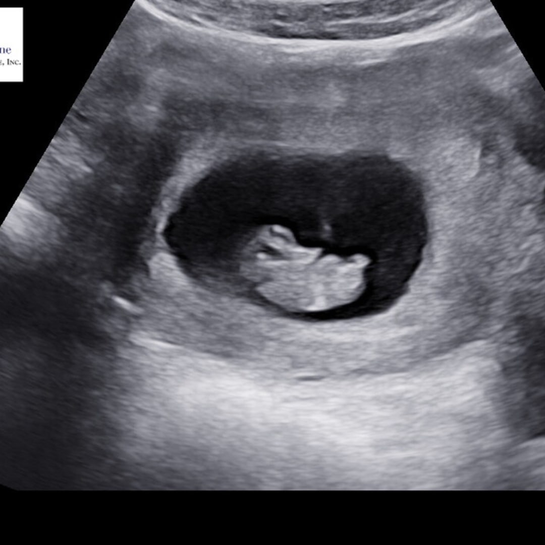 Photo shared by Alyssa for their Babylist baby registry.