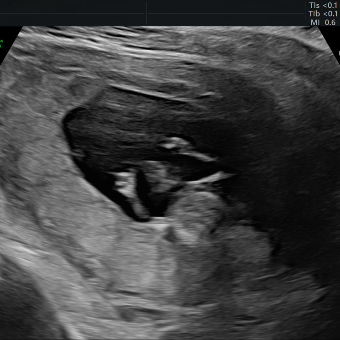 Photo shared by Hannah for their Babylist baby registry.