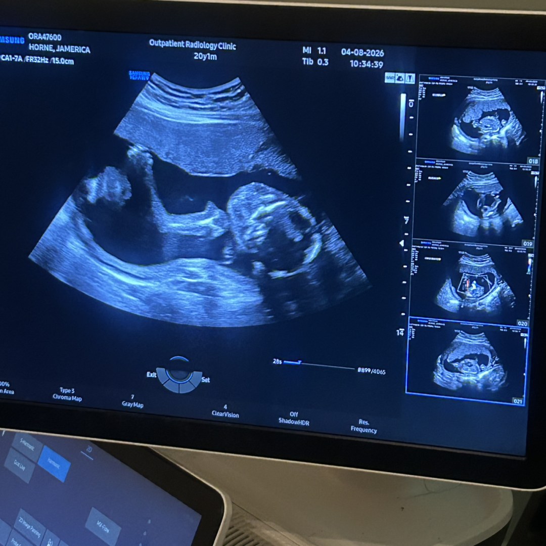 Photo shared by Jamerica for their Babylist baby registry.