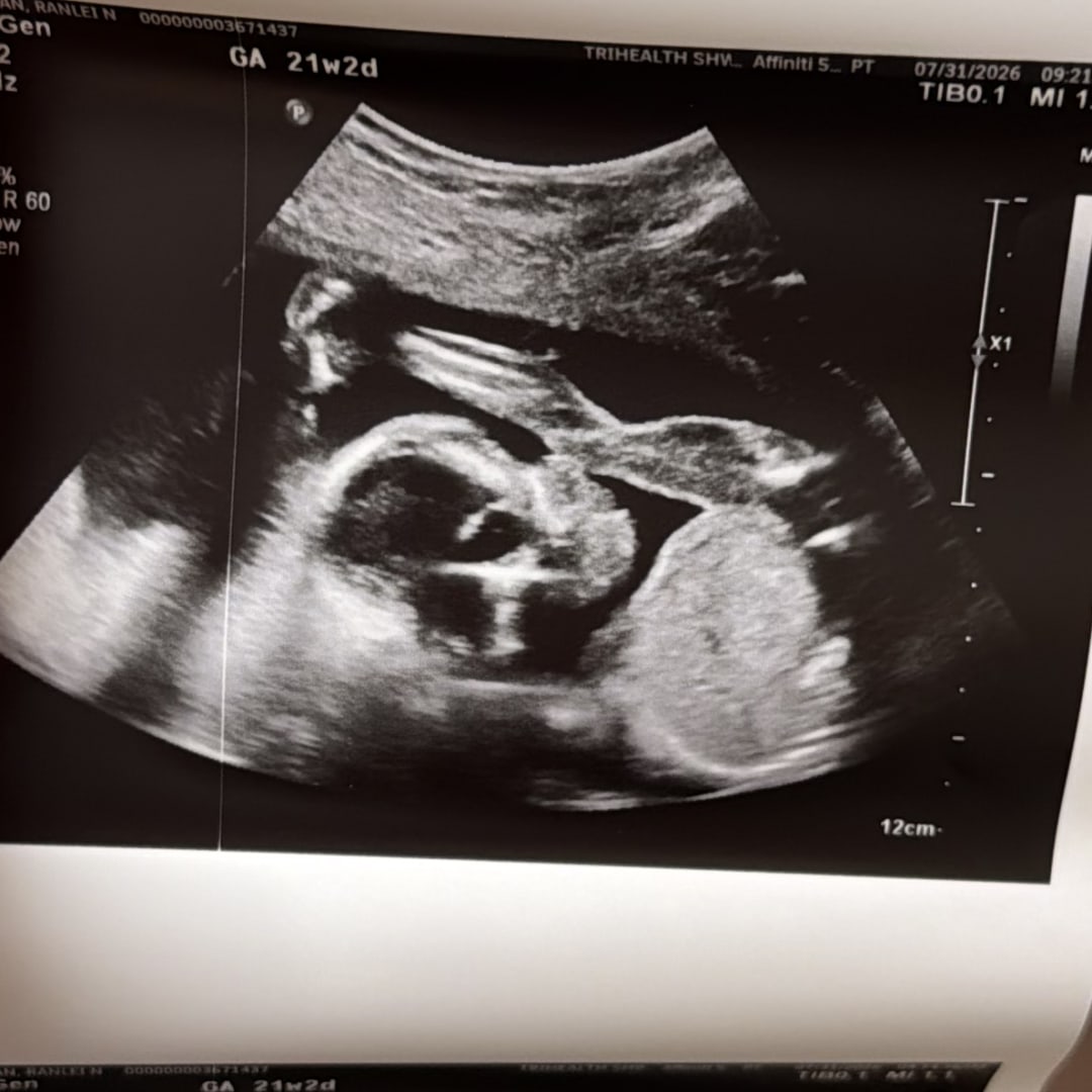 Photo shared by Ranlei for their Babylist baby registry.