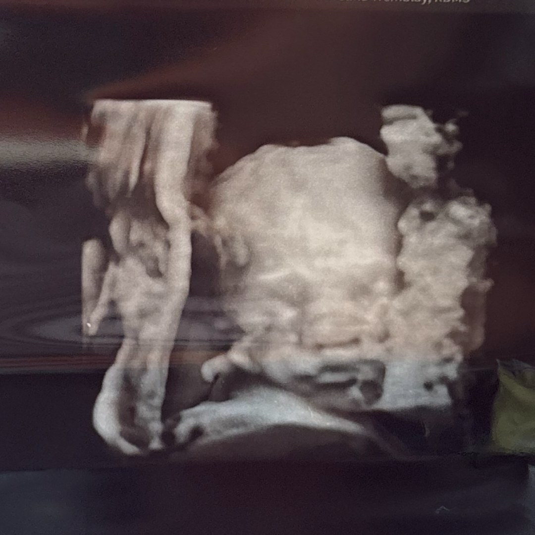 Photo shared by Alanis for their Babylist baby registry.