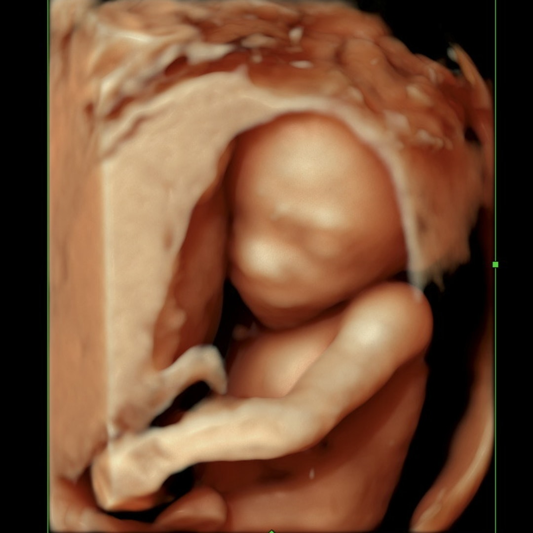 Photo shared by Skyler for their Babylist baby registry.