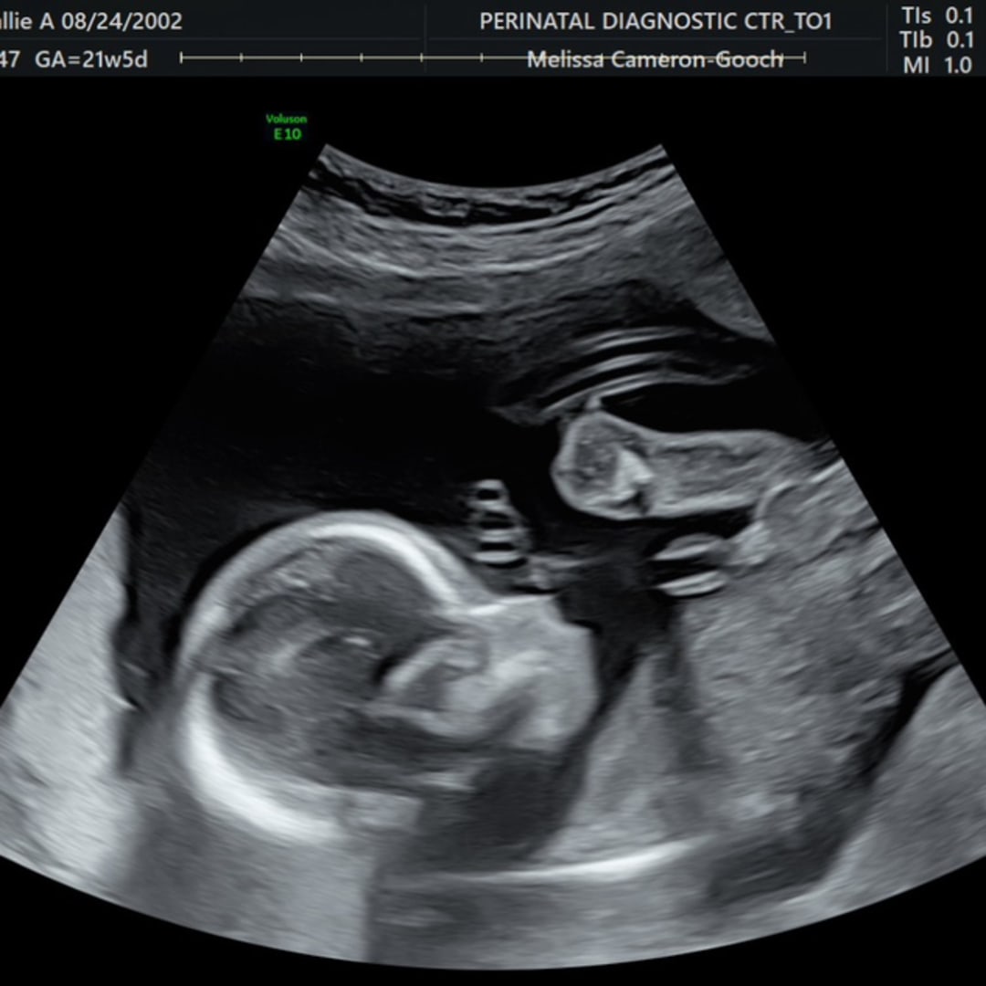 Photo shared by Callie for their Babylist baby registry.