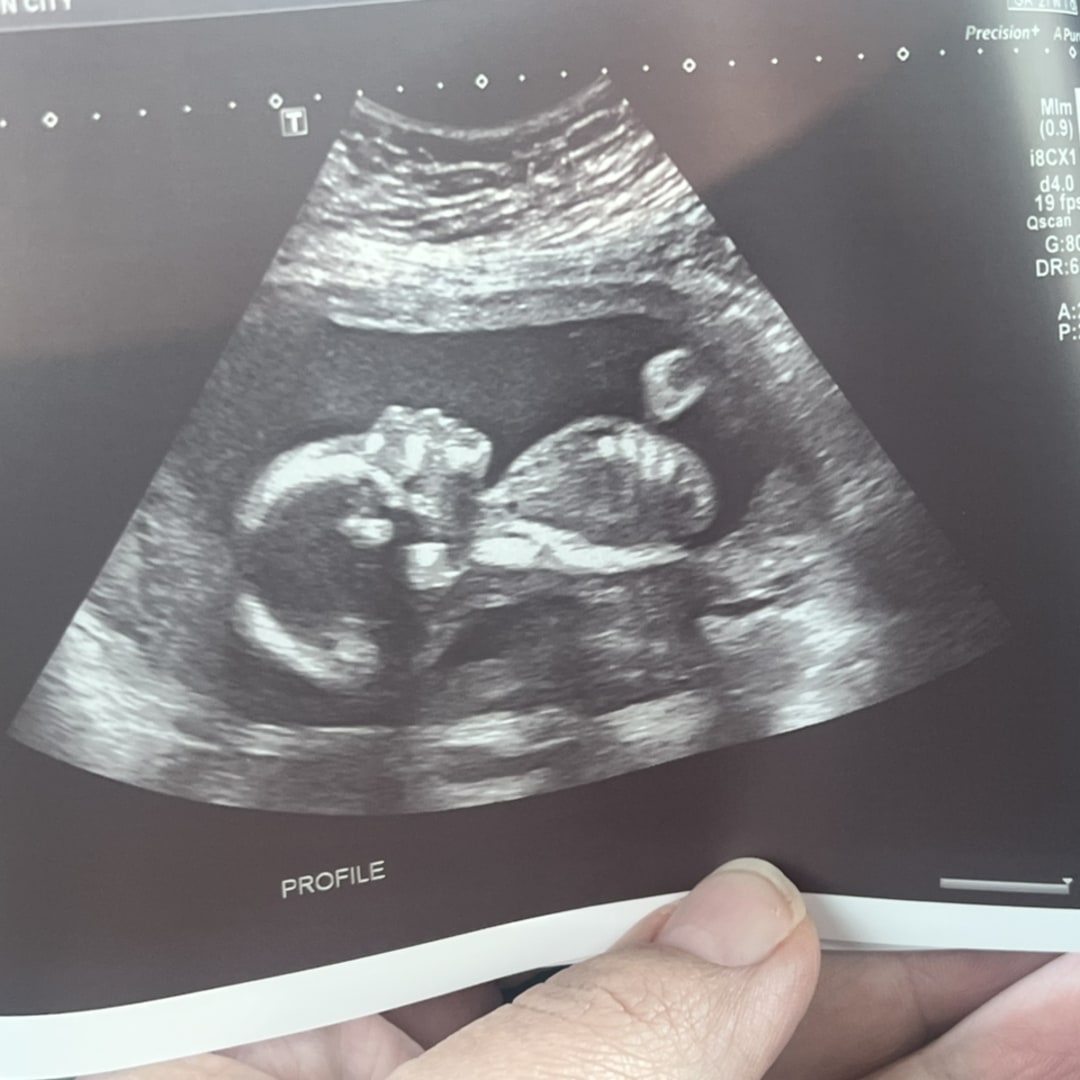 Photo shared by Carolyn for their Babylist baby registry.