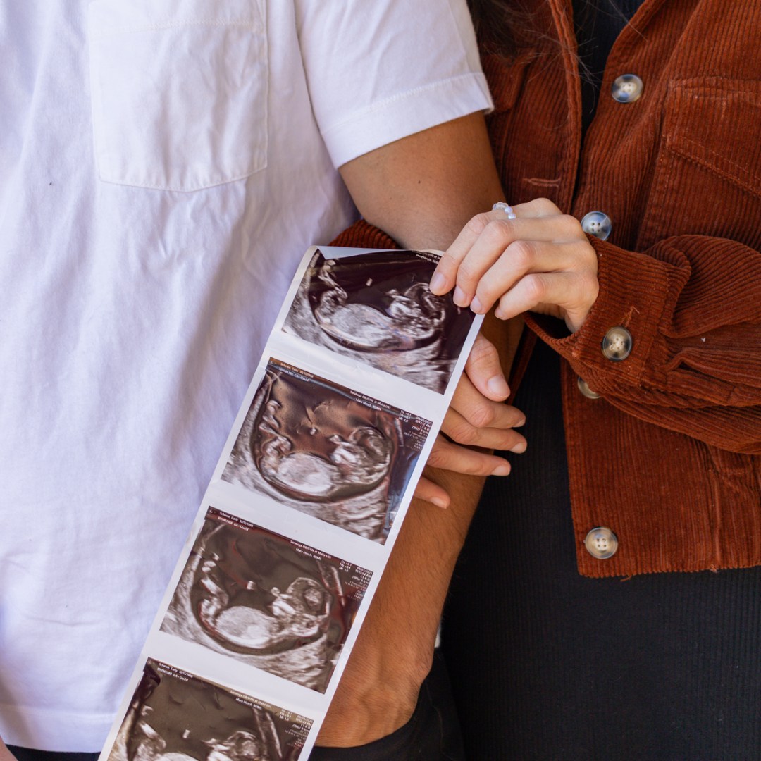 Photo shared by Carly for their Babylist baby registry.