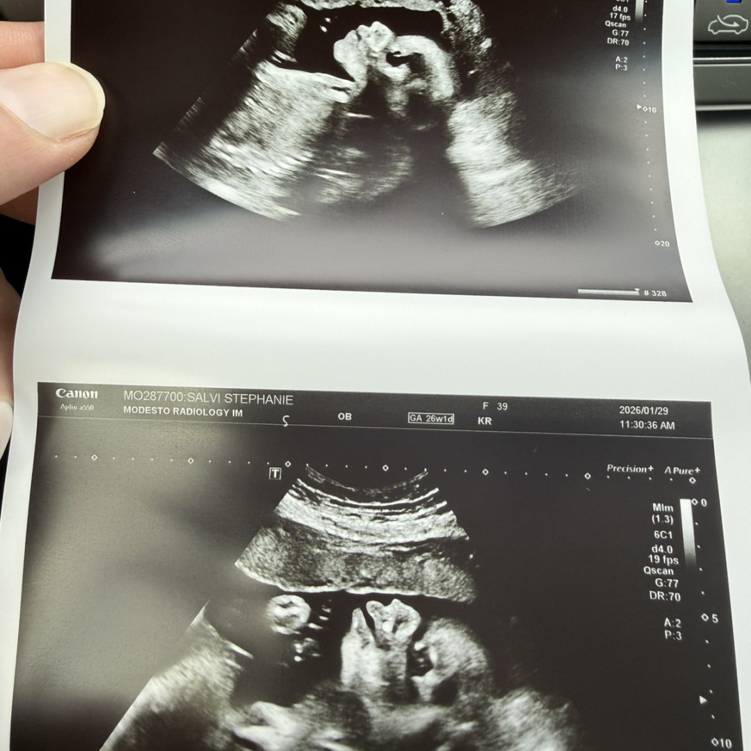 Photo shared by Stephanie for their Babylist baby registry.