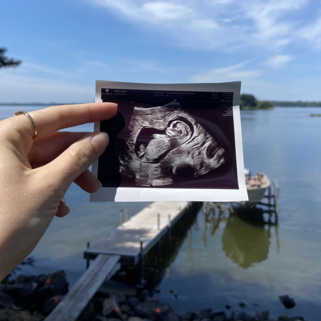 Photo shared by Emily for their Babylist baby registry.