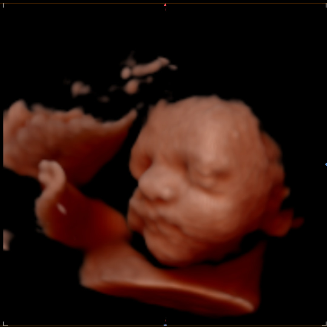 Photo shared by Samantha for their Babylist baby registry.